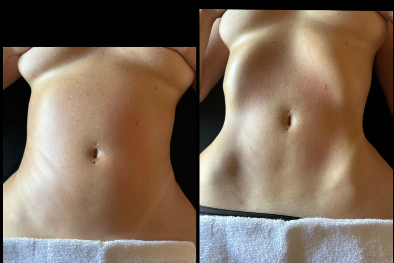 Abdomen Sculpting Massage- 45 MINS